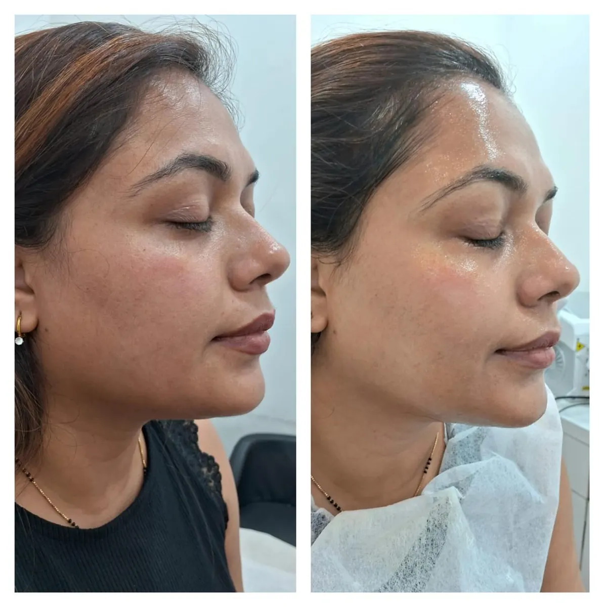 Real skin result at Image Clinic