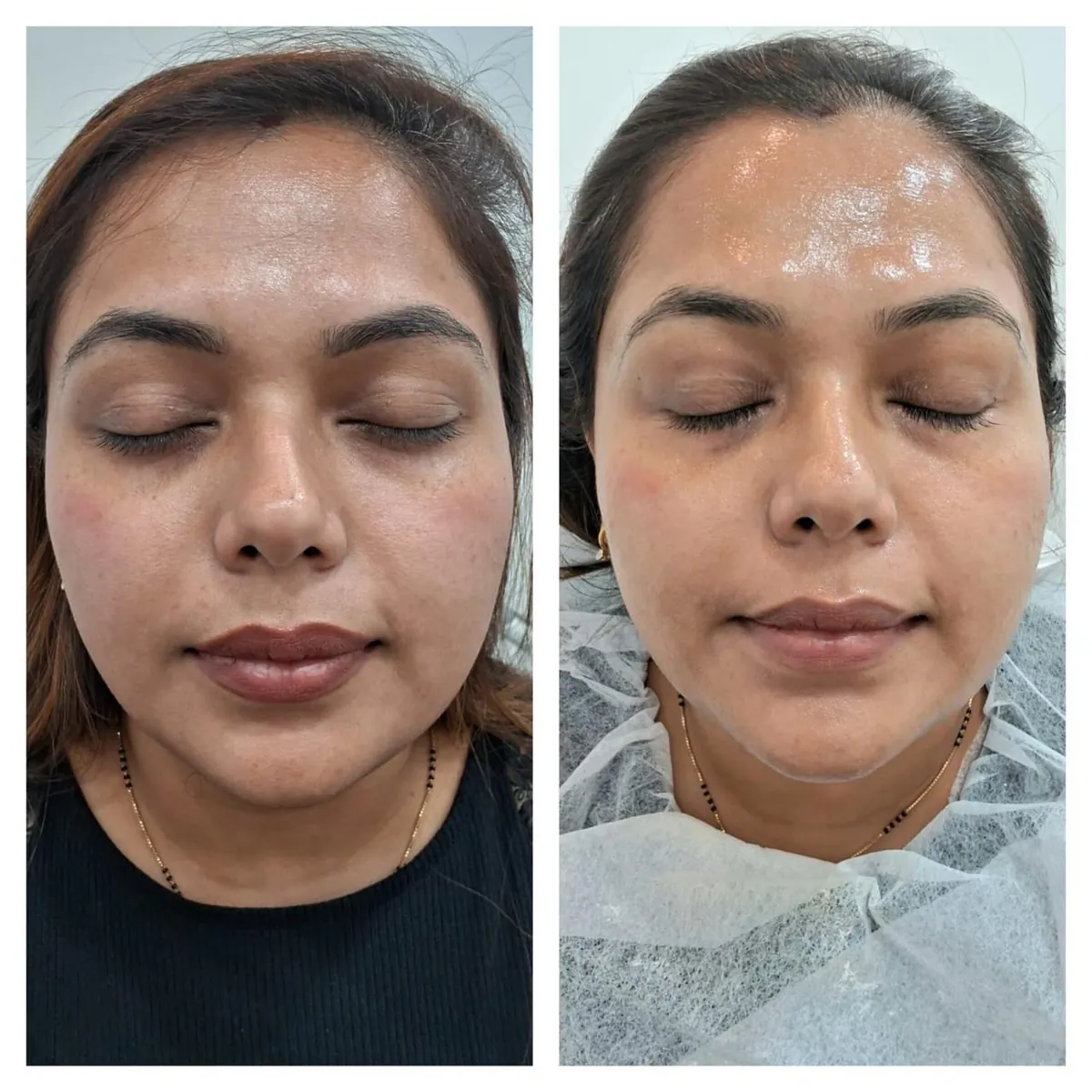 Real skin result at Image Clinic